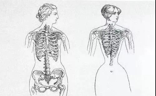 戴束腰内脏下垂,盆底肌漏尿穿收腹束腰能修复吗