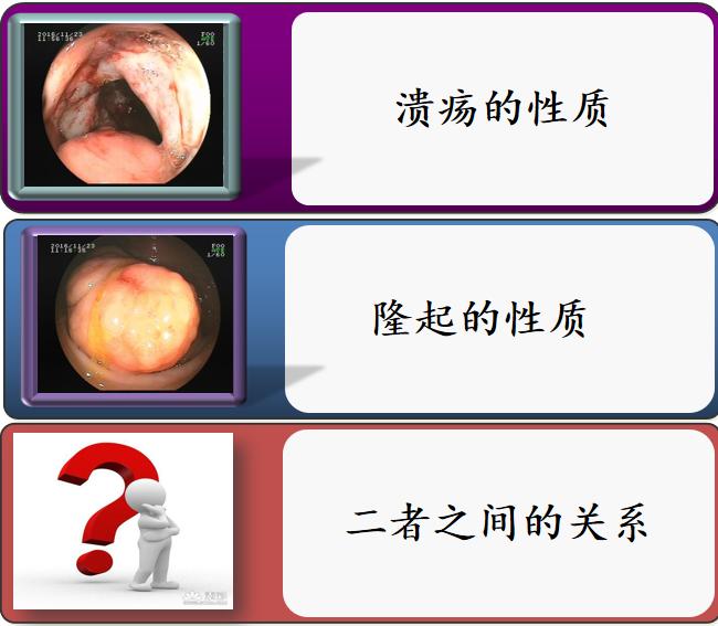 有一种口腔溃疡叫白塞病,反复口腔溃疡已经20年是白塞病吗