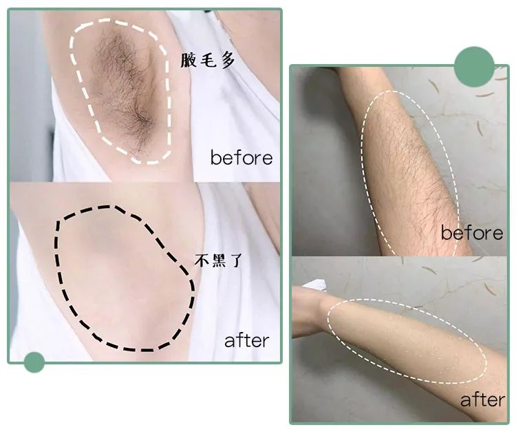 脱毛效果最好的老国货,老牌国货脱毛好物推荐