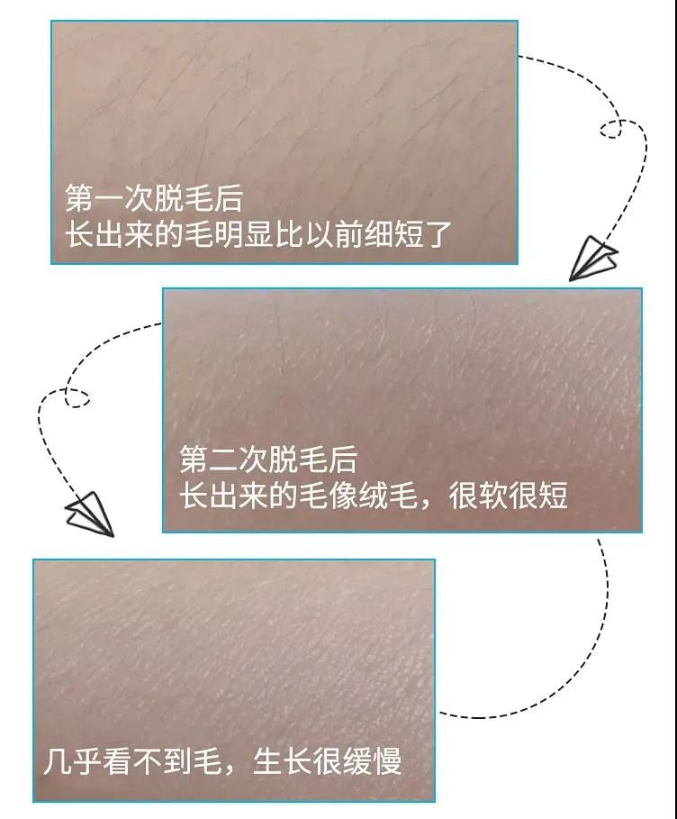 脱毛效果最好的老国货,老牌国货脱毛好物推荐