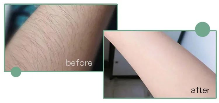 脱毛效果最好的老国货,老牌国货脱毛好物推荐