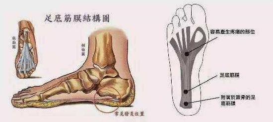 明明脚没有伤但脚还是疼为什么,脚底没有受伤但会痛是怎么回事