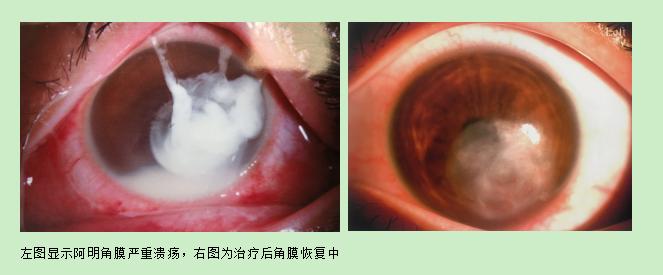 眼睛被飞虫撞红肿怎么办,飞虫撞到眼