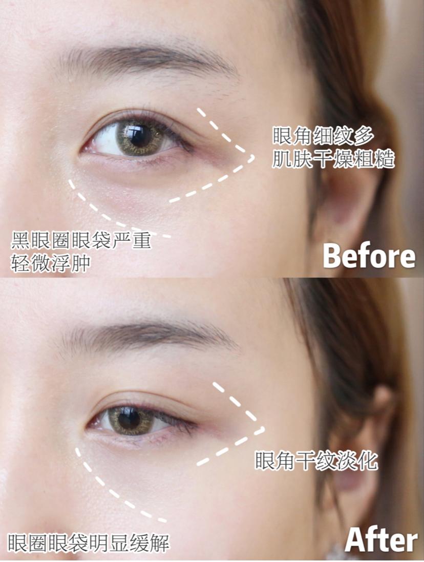 海蓝之谜lamer全新精华凝霜清爽型,lamer海蓝之谜眼霜礼盒