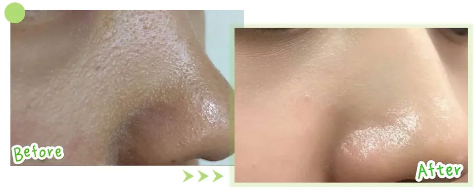 蜜诗肌酵素去角质凝胶,蜜诗肌酵素去角质