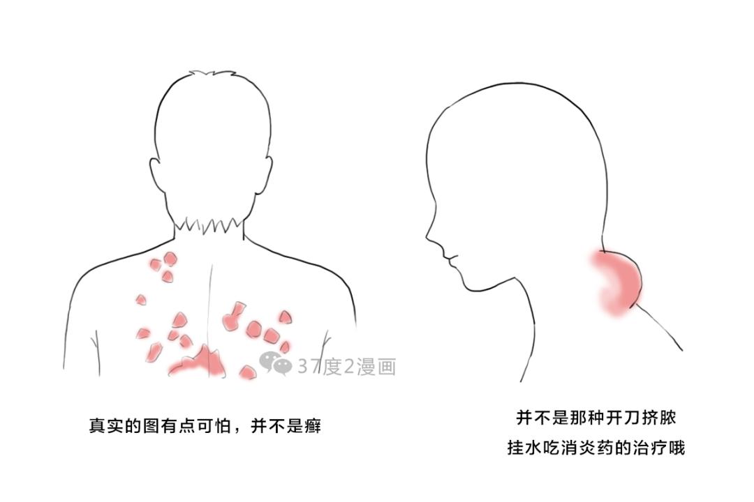 孟浩然吃鱼的危害,孟浩然是吃鱼死的吗