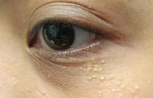 眼霜中的爱马仕！清爽不长脂肪粒，去黑眼圈效果秒2000元腊梅，亲测有效