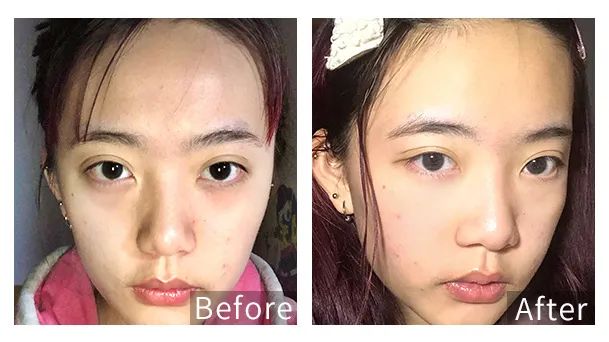 眼霜中的爱马仕！清爽不长脂肪粒，去黑眼圈效果秒2000元腊梅，亲测有效