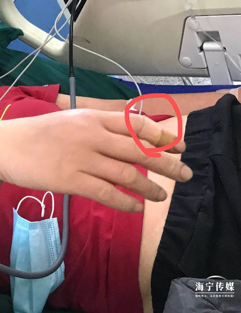 十大毒虫咬人后的症状,十大毒虫咬人了怎么办