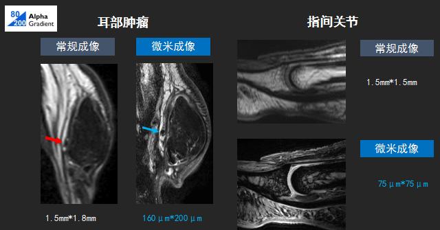 压缩时间、感知精华——西北首台3.0T光速科研型磁共振在我院投入运行