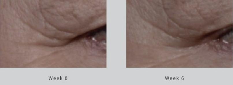 超好用的mila湿敷棉,美妆博主推荐的平价湿敷水