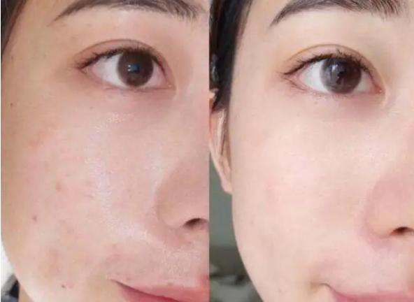 泰国人用什么防晒,泰国人参防晒