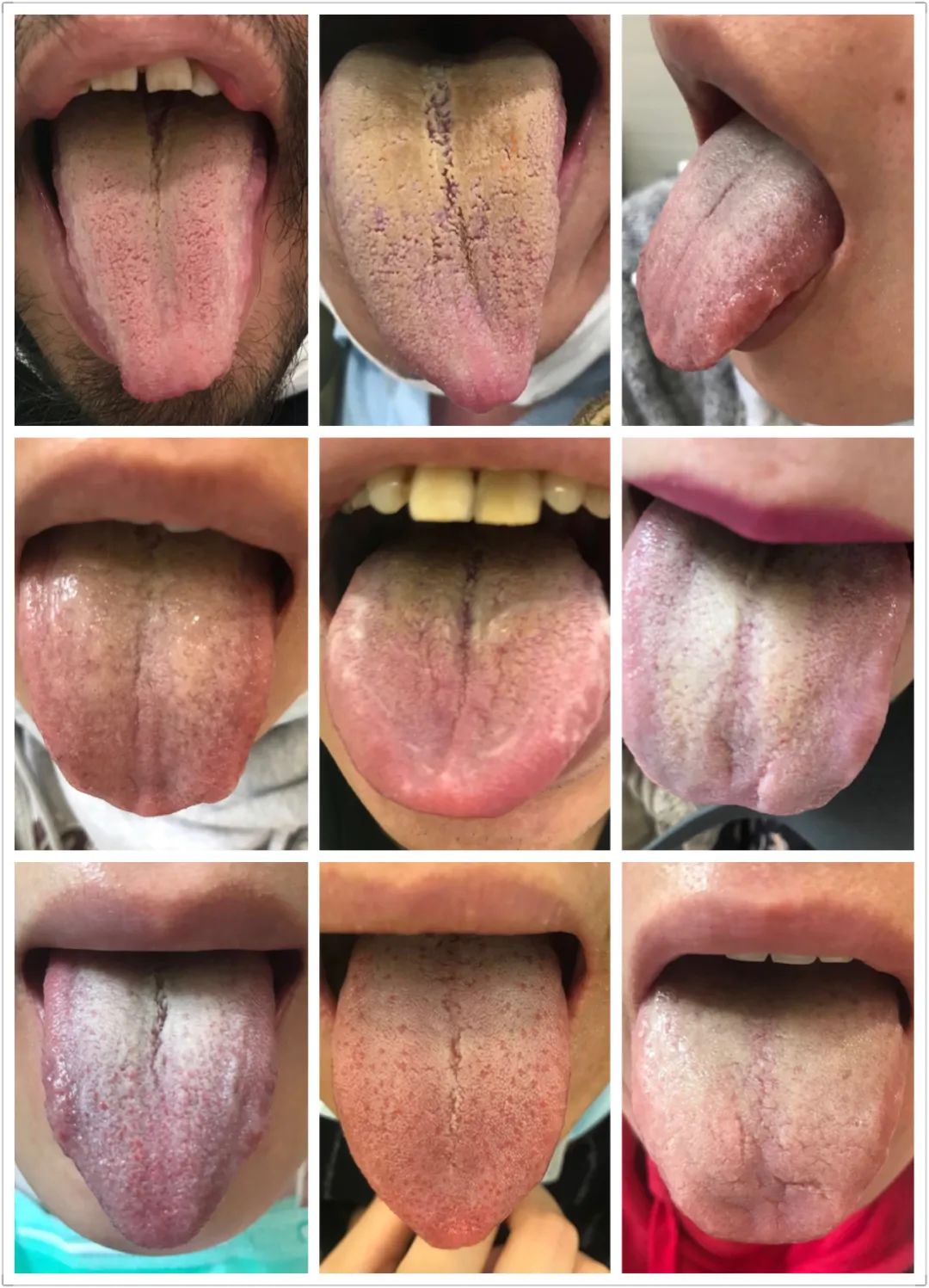 泡脚祛湿气会导致生湿疹吗,脚上有湿疹中药泡脚的方法