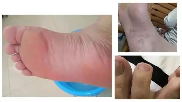 一双能按摩的浴室拖鞋,Q软防滑,好穿到爆,每一步都在保健