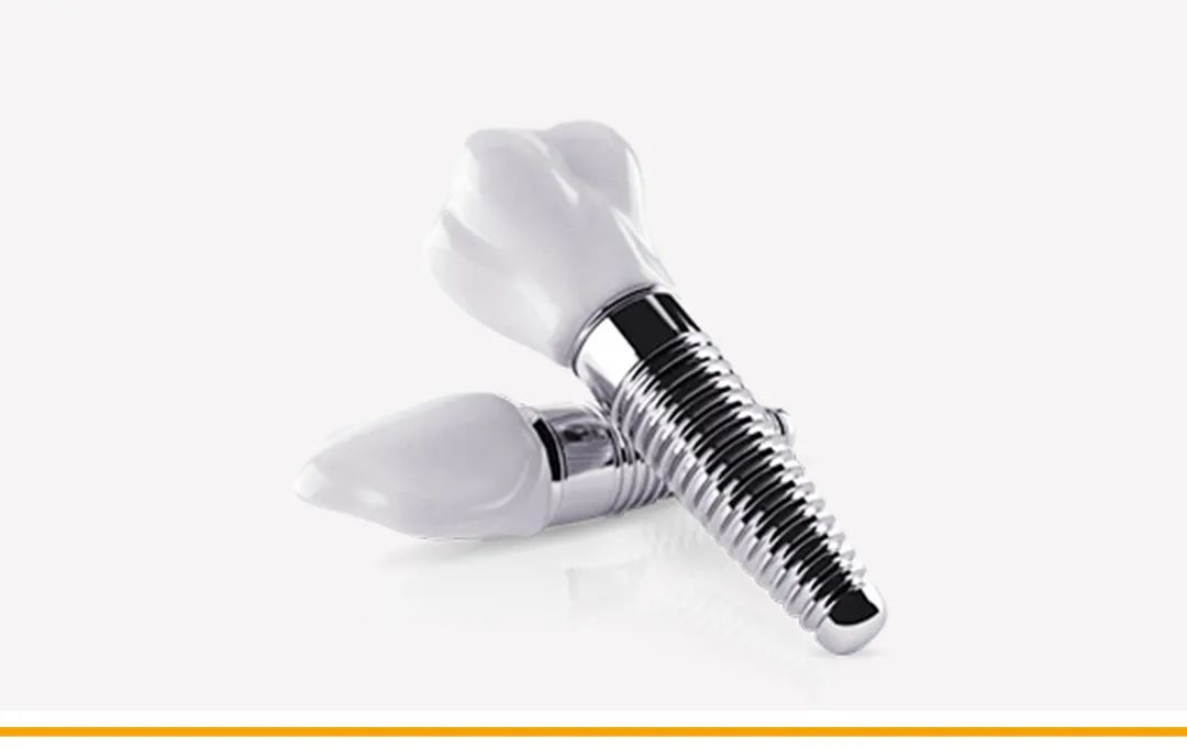 上海摩尔口腔医院实际种牙价格,种牙优诺口腔