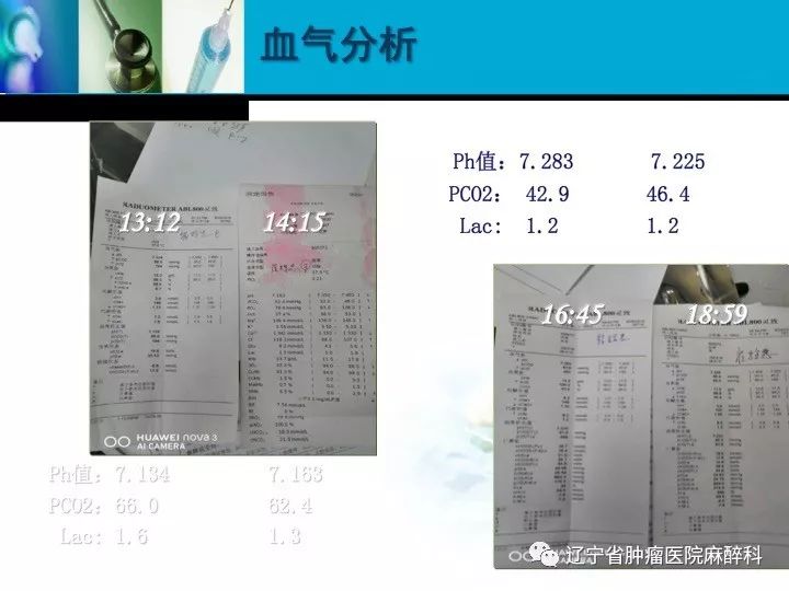 肺癌晚期上腔静脉综合征,上腔静脉综合征排期