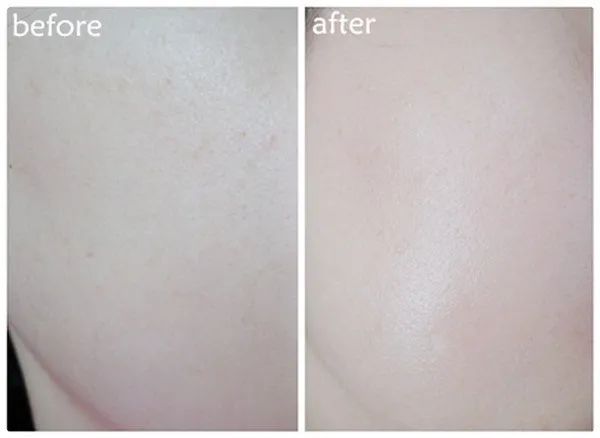 见效快的睡眠面膜,特好用的睡眠面膜