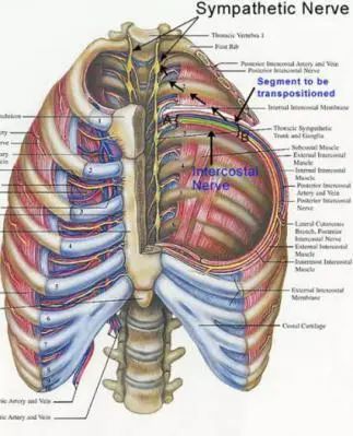 她为这病自卑了20多年，没想到神奇的两根针一扎，治好了