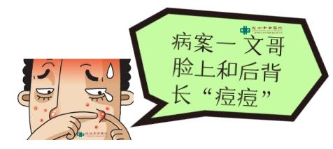 治疗青春痘中医古方也能迅速奏效,奇效火针治疗青春痘