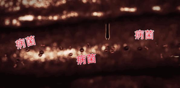 教你2分钟快速止痒,一小瓶止痒的药膏