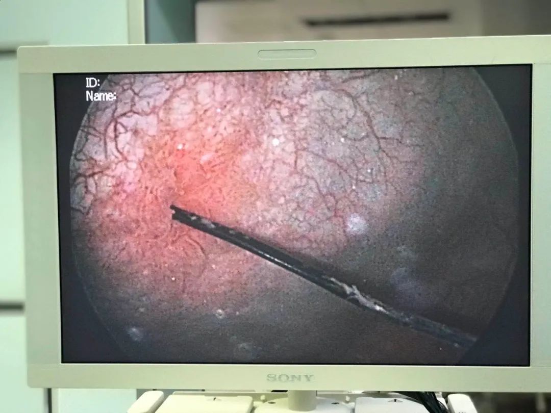 鐔婂瀛愭拻灏胯棌鍦ㄧ瀛愰噷鍚庣画,鐔婂瀛愭拻灏胯棌鍦ㄧ瀛愰噷