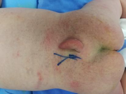 臀部返祖现象,返祖现象长尾巴