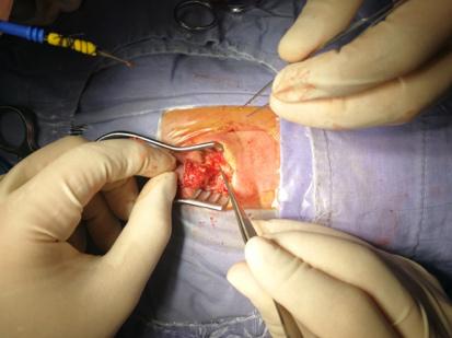 臀部返祖现象,返祖现象长尾巴