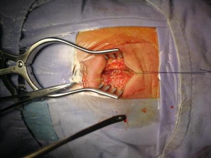 臀部返祖现象,返祖现象长尾巴