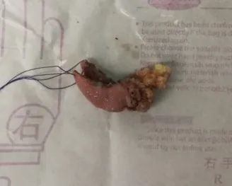 臀部返祖现象,返祖现象长尾巴