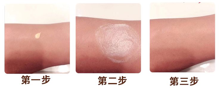 皮炎湿疹抹凡士林能抹多久,湿疹足癣用什么药膏最有效