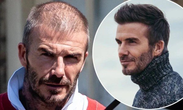 拯救发际线更好的改变自己,拯救发际线高额头大的发型