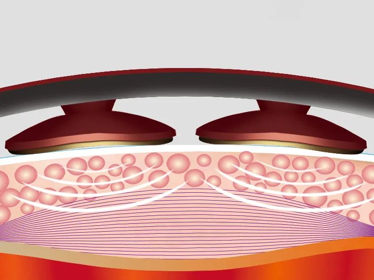 颈椎磁疗法,颈椎正骨咔咔响原声