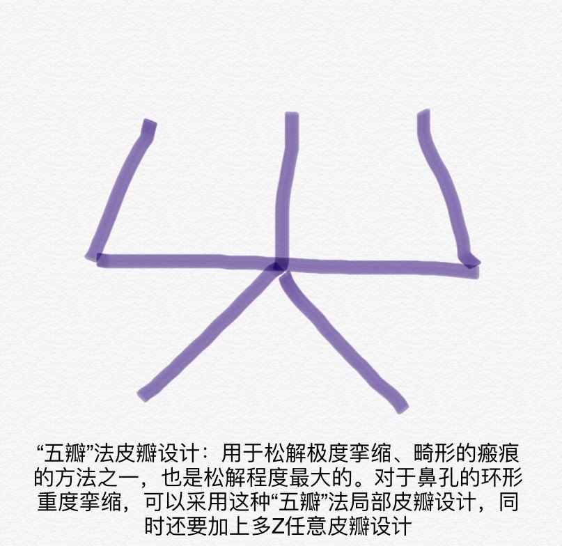 高难度扁鼻子修复,鼻综合手术疤痕修复