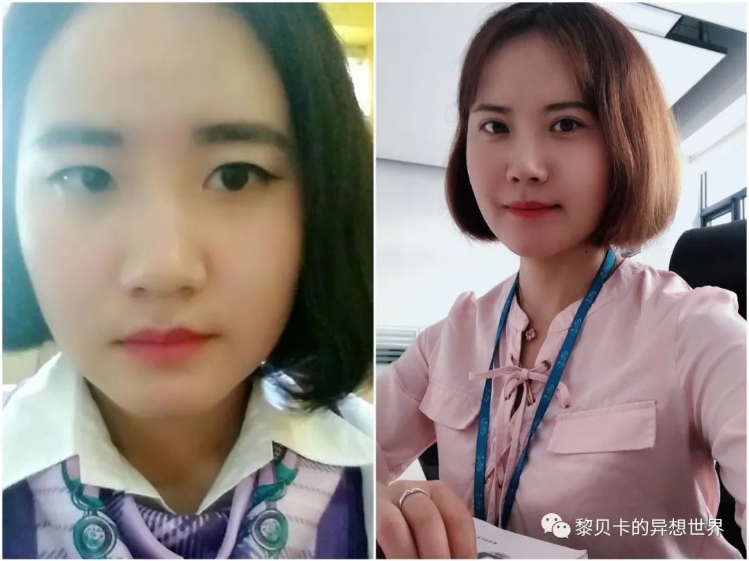 做完医美用可复美吗,你知道做完医美有多可怕