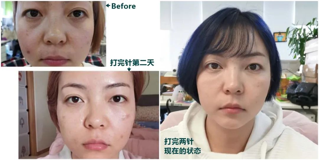 做完医美用可复美吗,你知道做完医美有多可怕