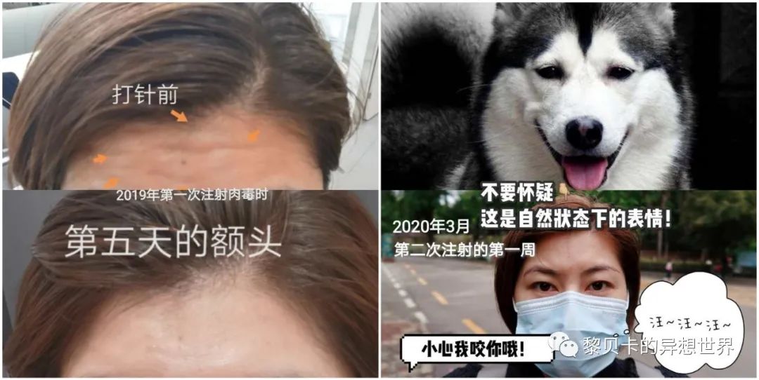 做完医美用可复美吗,你知道做完医美有多可怕