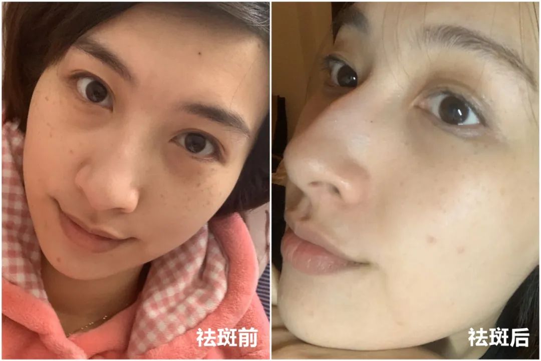 做完医美用可复美吗,你知道做完医美有多可怕