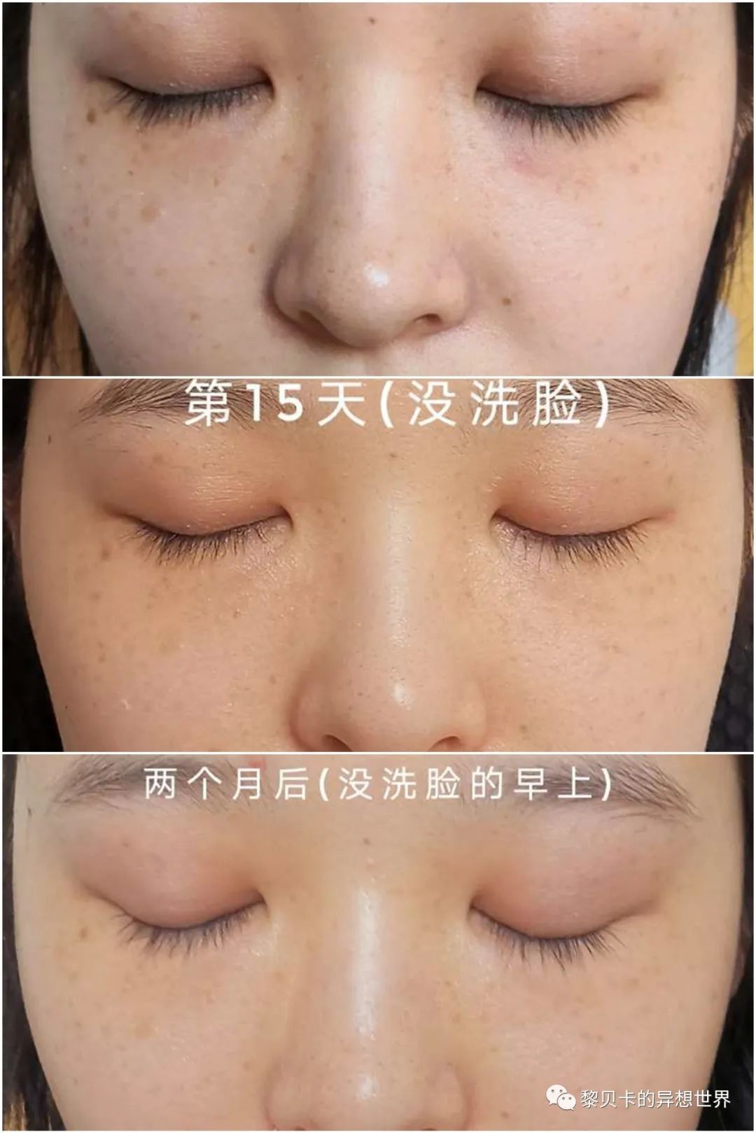 做完医美用可复美吗,你知道做完医美有多可怕