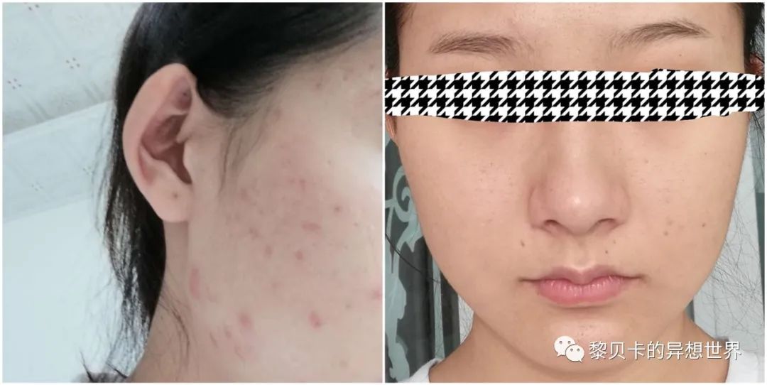 做完医美用可复美吗,你知道做完医美有多可怕