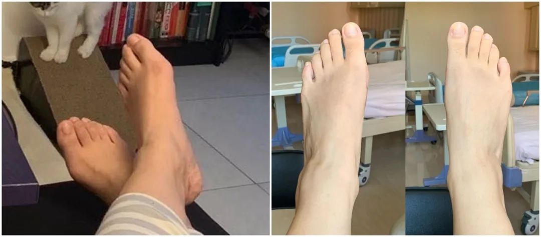 做完医美用可复美吗,你知道做完医美有多可怕