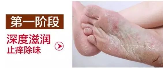 脚臭脱鞋多久可以去味,脚臭喷鞋袜除臭