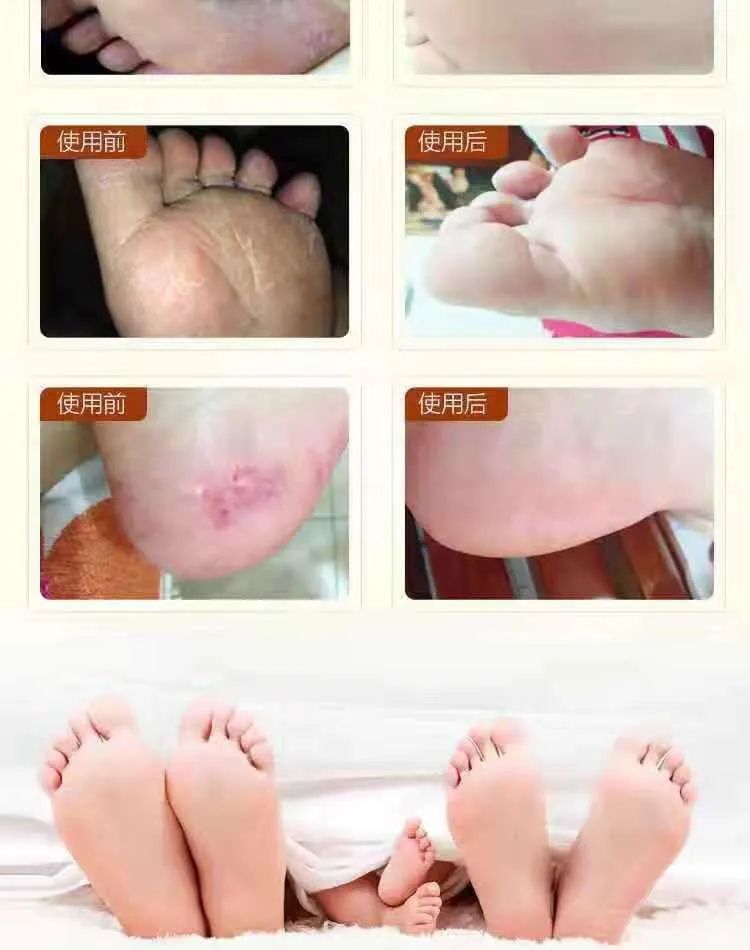 脚臭脱鞋多久可以去味,脚臭喷鞋袜除臭