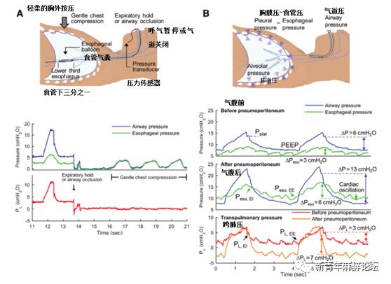 跨肺压与驱动压的区别,驱动压和跨肺压区别
