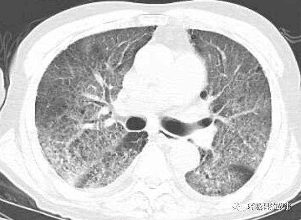 输盐水的目的,生病输盐水有什么用