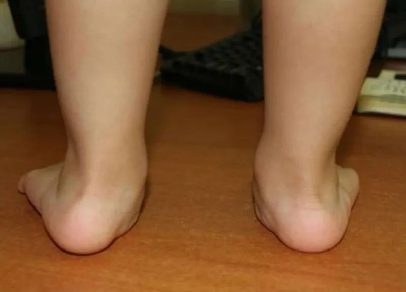 手足外科微创手术,巴彦淖尔市医院手足显微外科