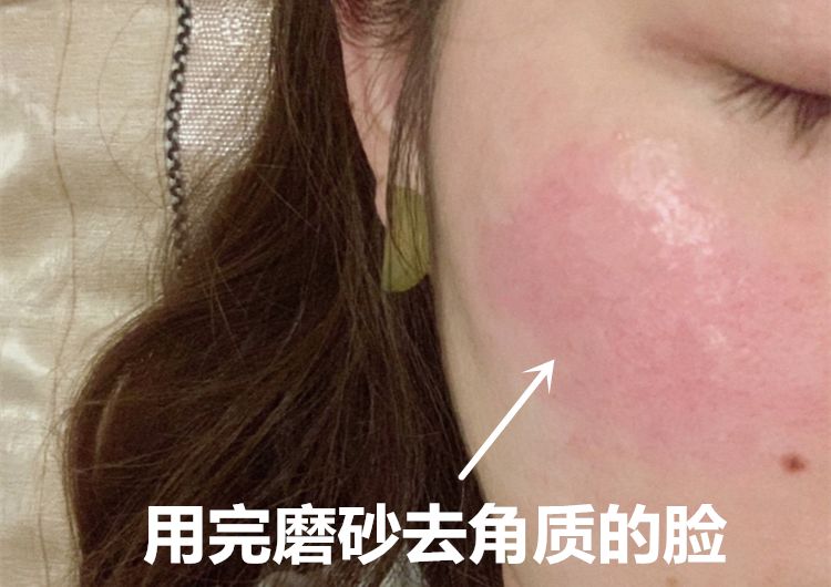 用手搓脸搓出泥把脸搓掉皮,用它搓一搓皮肤嫩滑透亮不显老