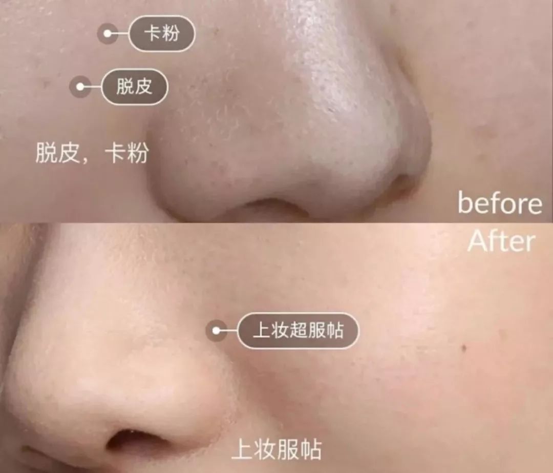 用手搓脸搓出泥把脸搓掉皮,用它搓一搓皮肤嫩滑透亮不显老