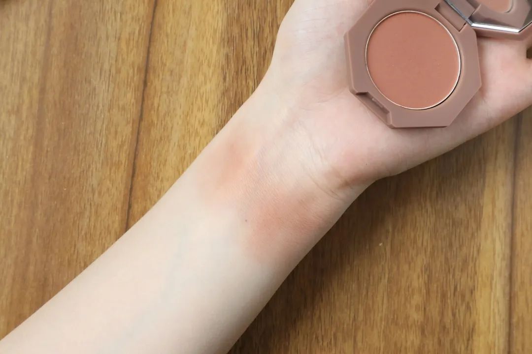 周雨彤祛痘神器,周雨彤的泪沟神器