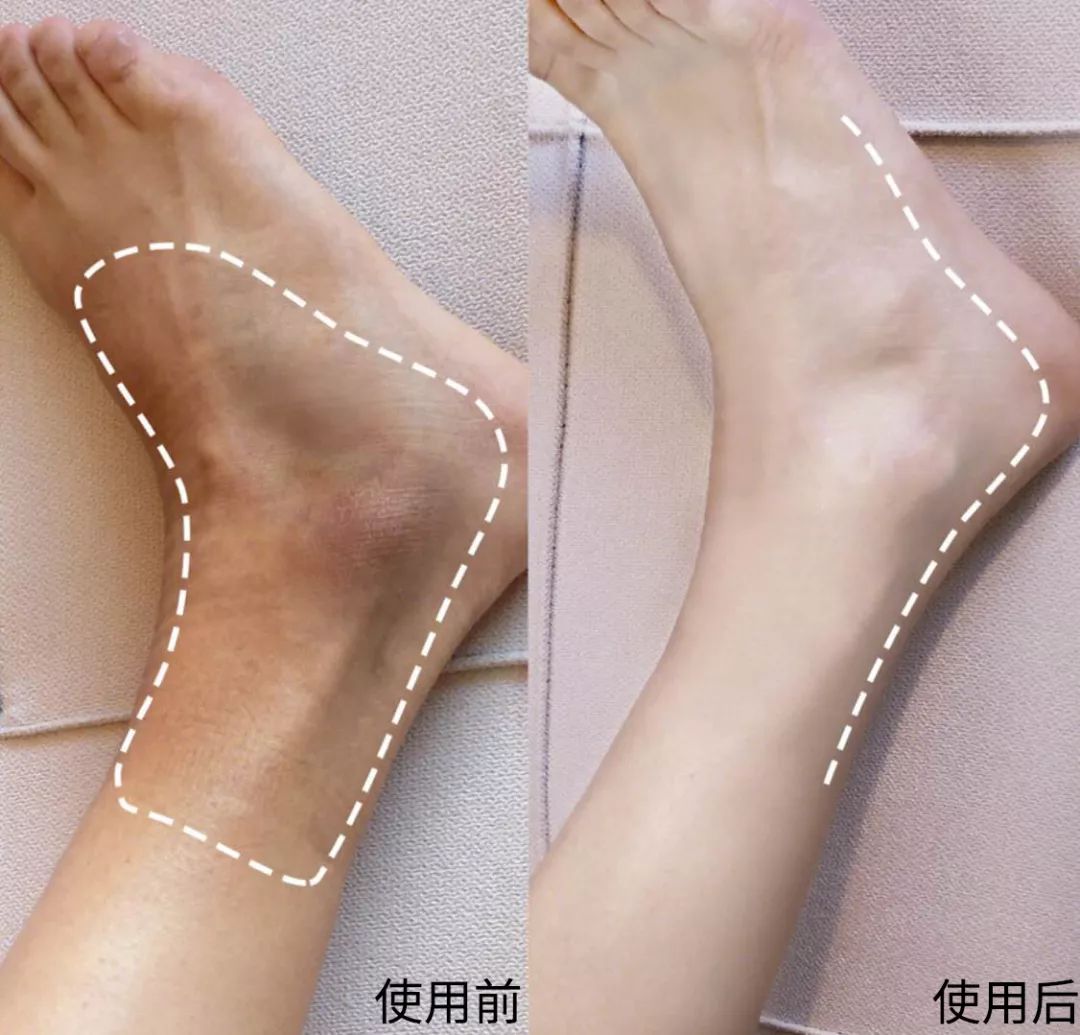 为什么夏天不露腿了,夏天不露腿热吗