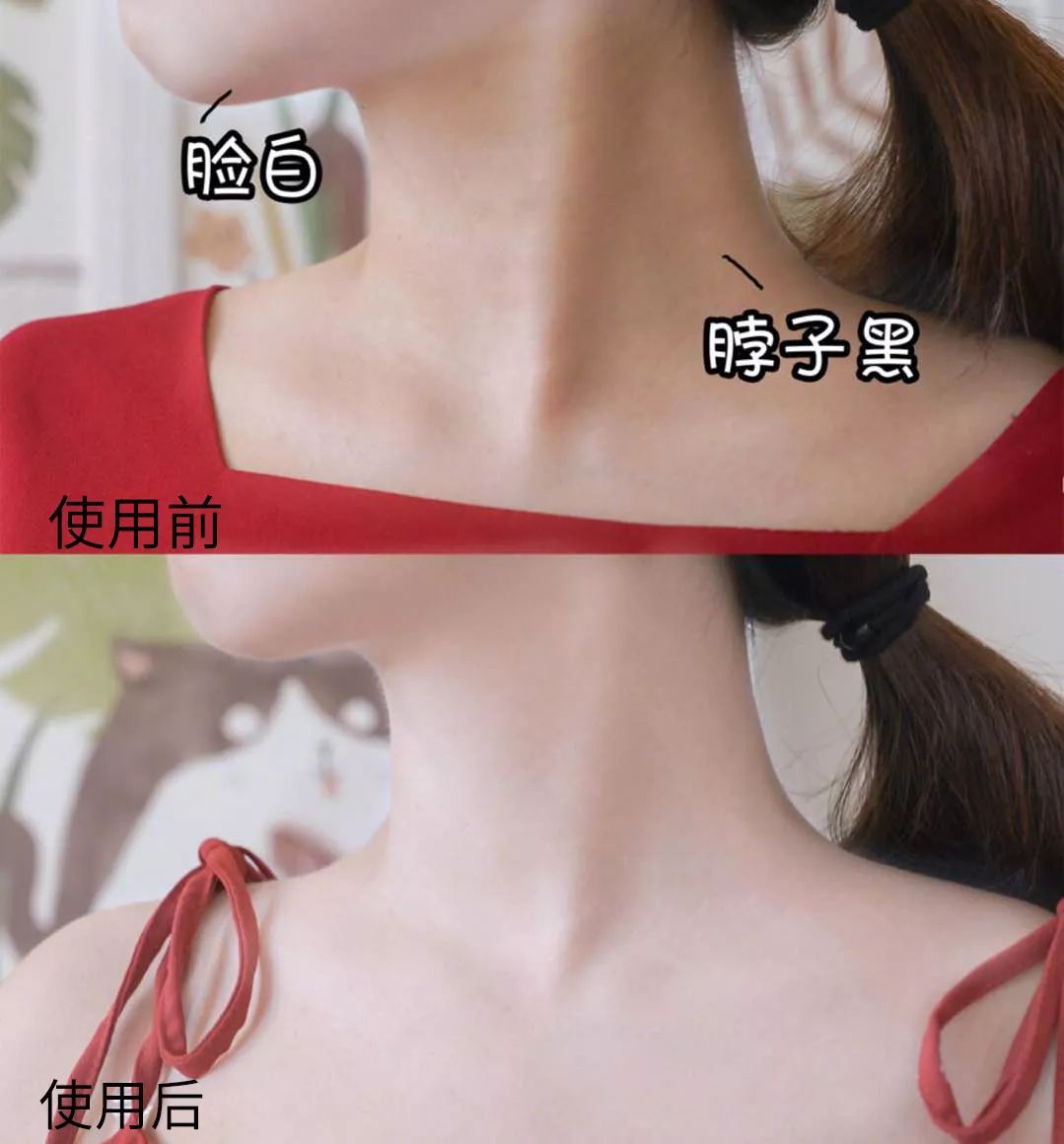 为什么夏天不露腿了,夏天不露腿热吗